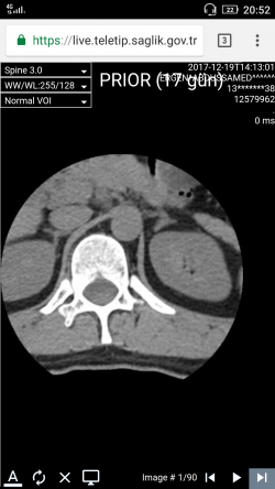 Screenshot_2018-01-20-20-52-22