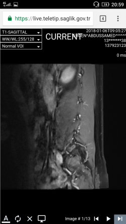 Screenshot_2018-01-20-20-59-28