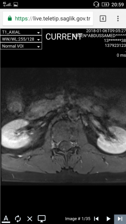 Screenshot_2018-01-20-20-59-35